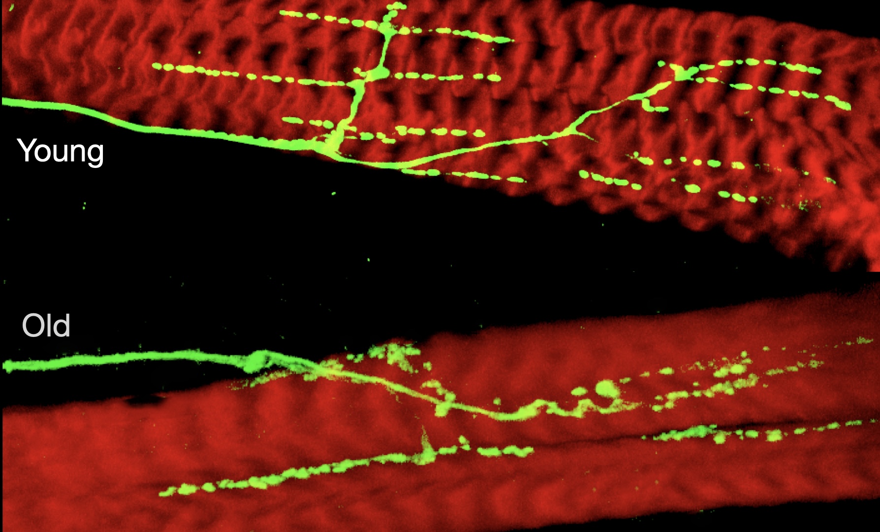 Young vs Aging NMJ comparison